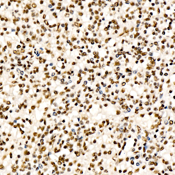 CHD4 Rabbit mAb