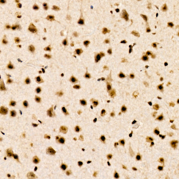 CHD4 Rabbit mAb