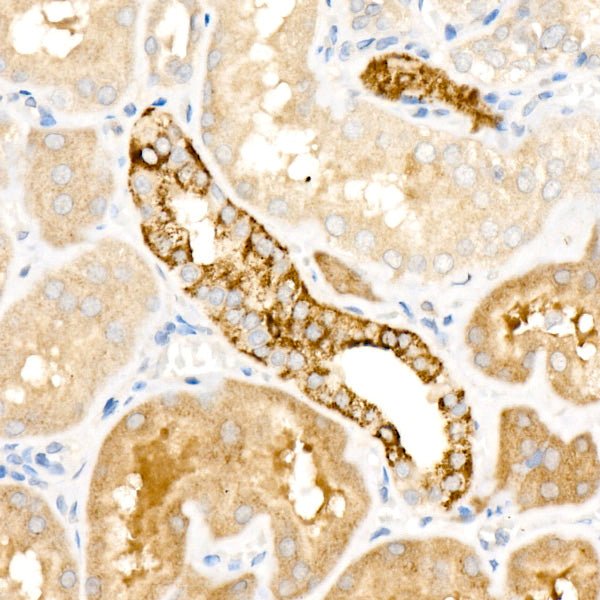 HMGCS2 Rabbit mAb