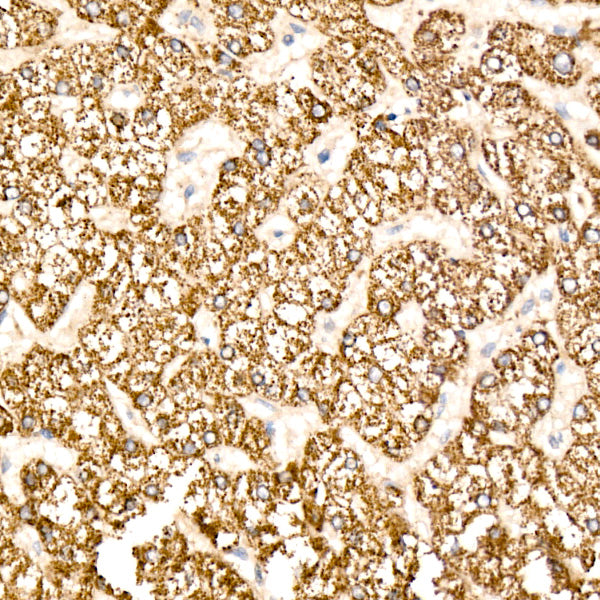 HMGCS2 Rabbit mAb