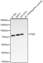 TLE2 Rabbit mAb