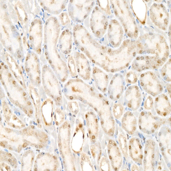 TLE2 Rabbit mAb
