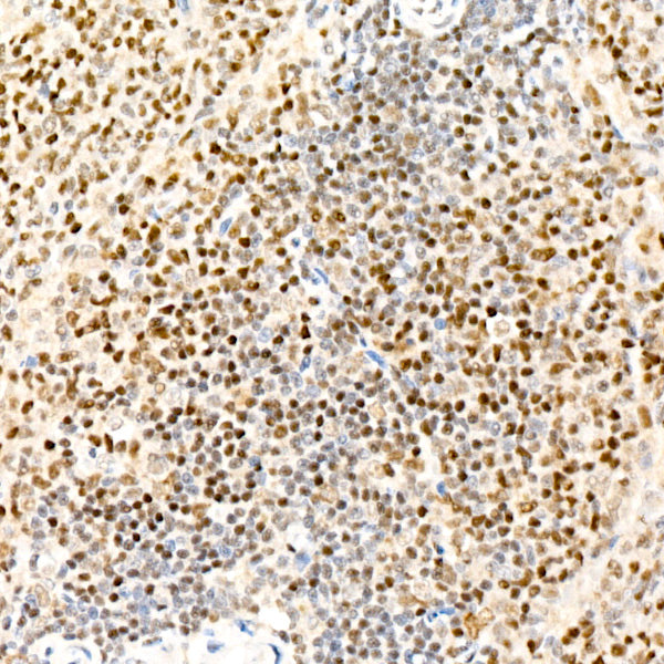 TLE2 Rabbit mAb