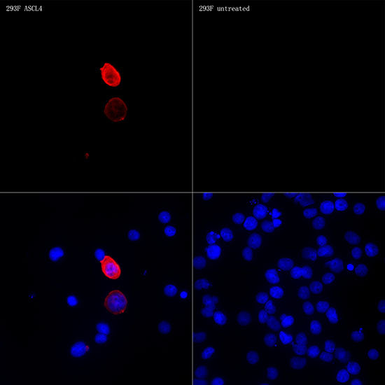 ASCL4 Rabbit mAb