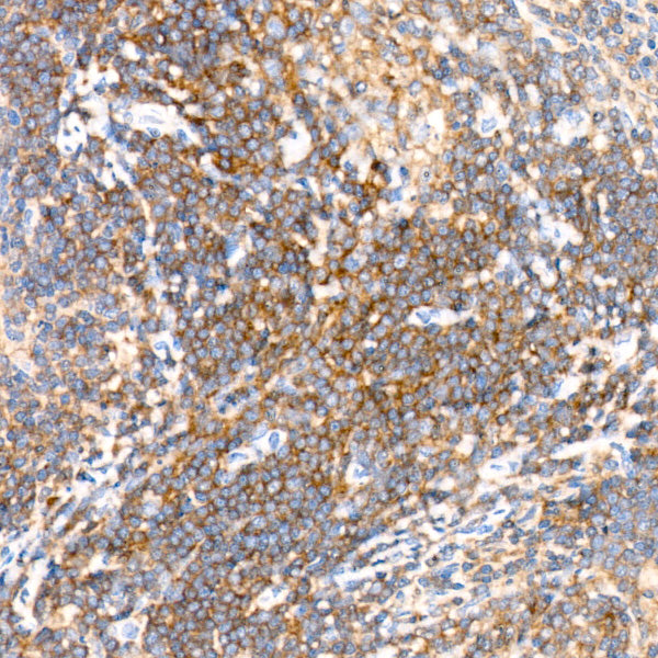 CD45 Rabbit mAb