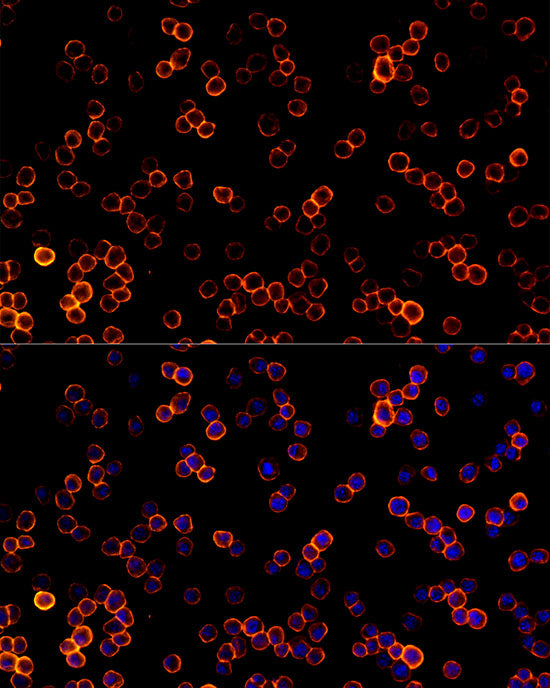 CD45 Rabbit mAb