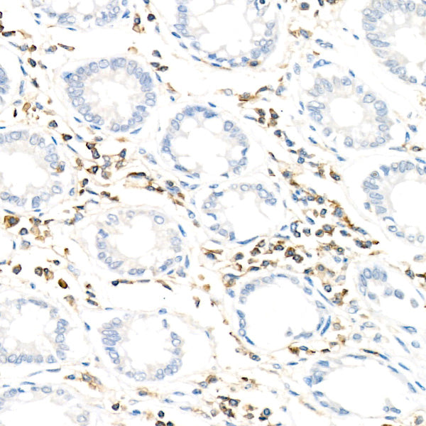CD352/SLAMF6 Rabbit mAb