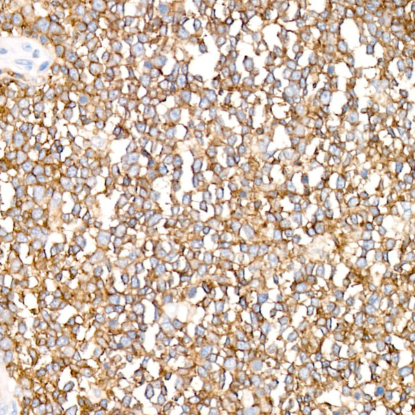 CD352/SLAMF6 Rabbit mAb