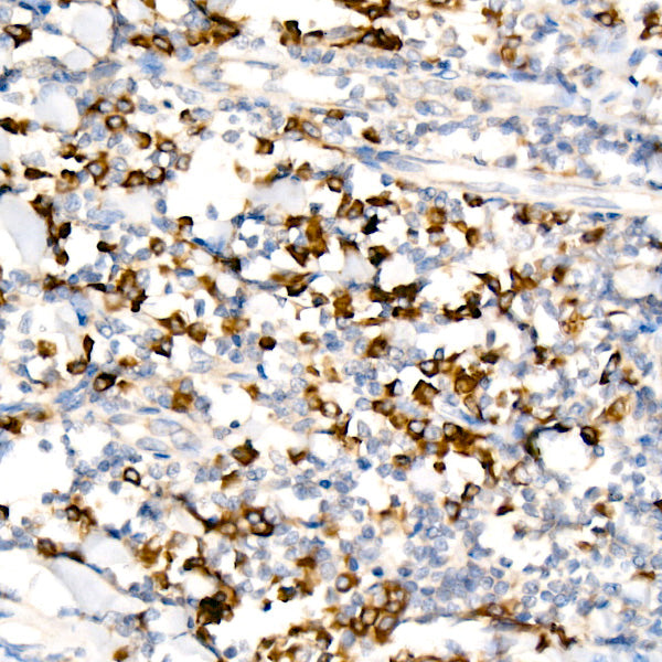 WNK3 Rabbit mAb