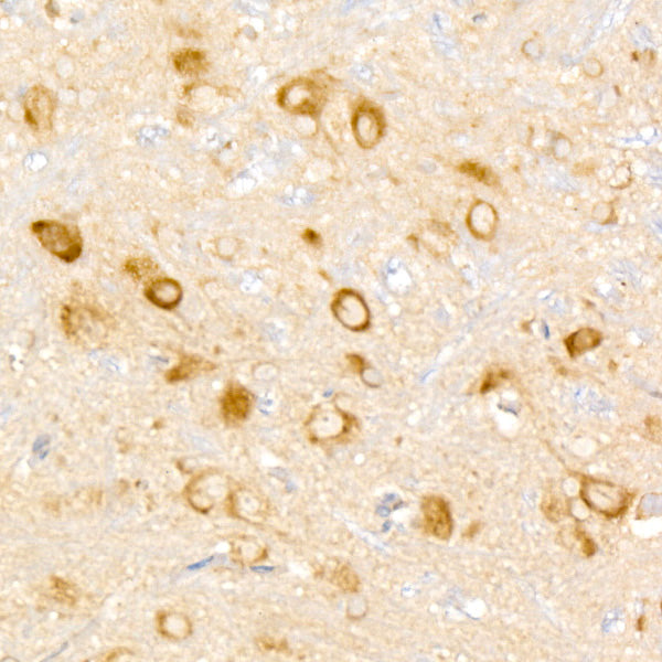 WNK3 Rabbit mAb