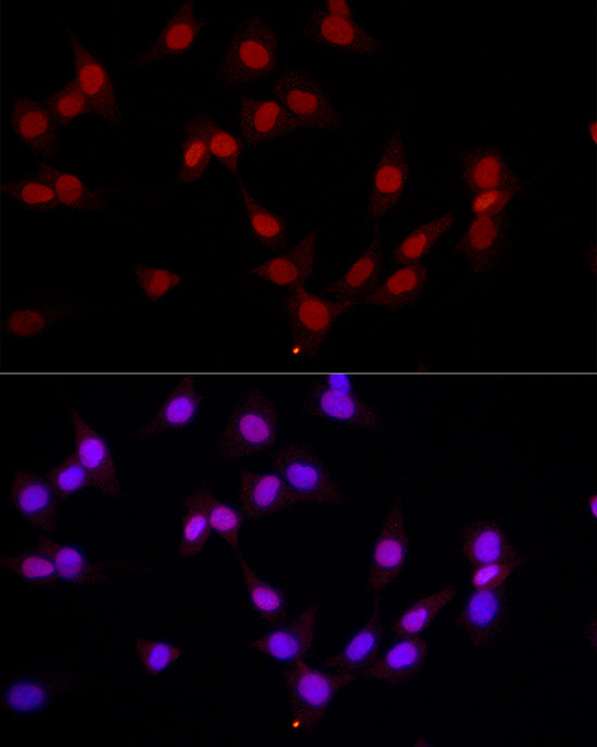 MonoMethyl-Histone H3-K4 Rabbit pAb