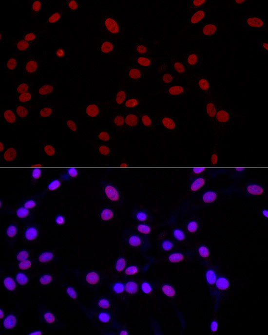 MonoMethyl-Histone H3-K4 Rabbit pAb