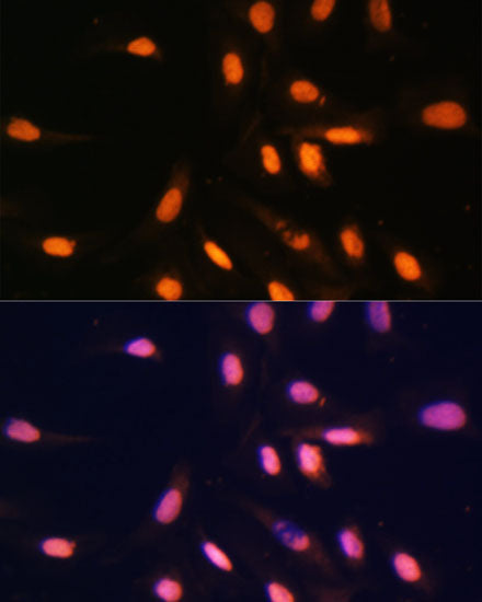 MonoMethyl-Histone H3-K4 Rabbit pAb