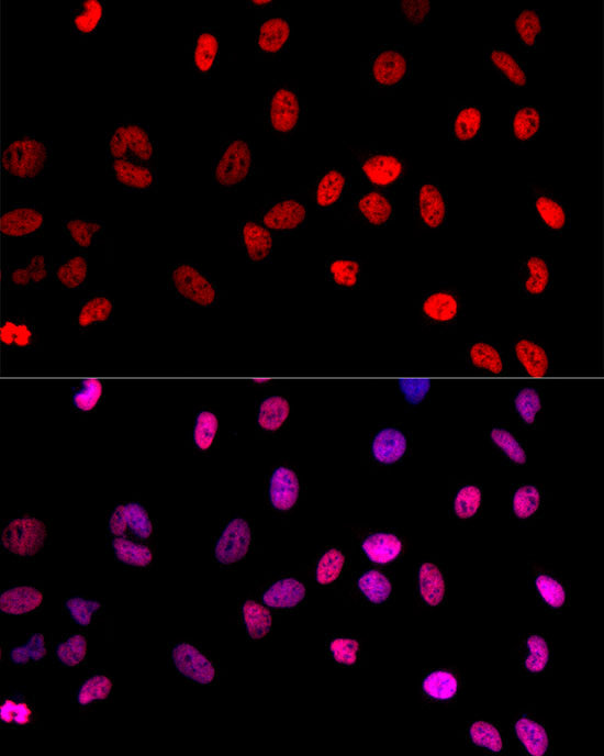 MonoMethyl-Histone H3-K4 Rabbit pAb