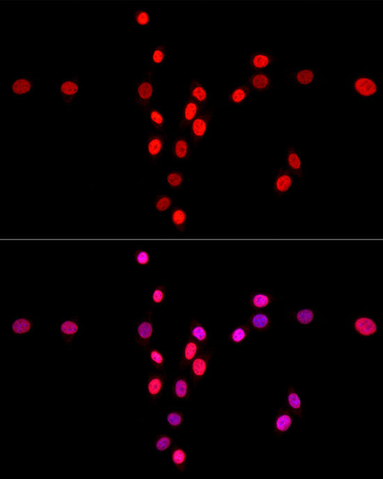 MonoMethyl-Histone H3-K4 Rabbit pAb