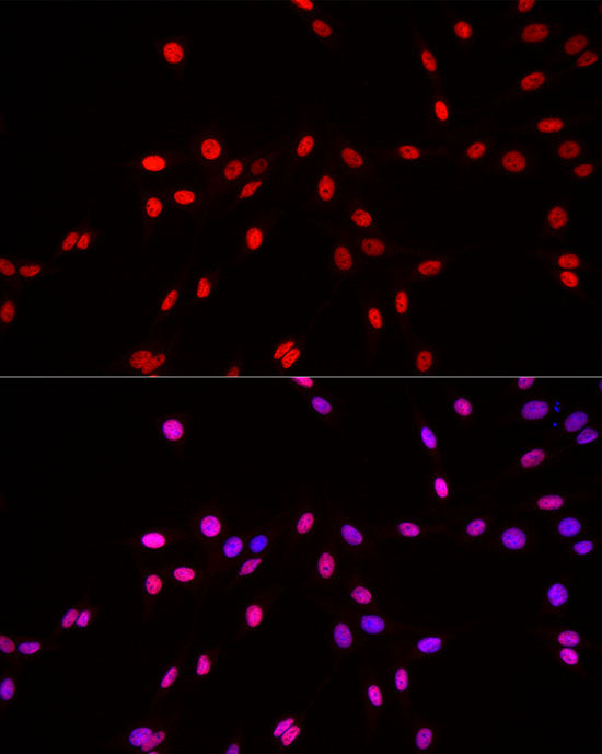 MonoMethyl-Histone H3-K4 Rabbit pAb