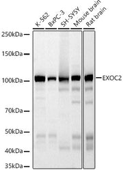 EXOC2 Rabbit mAb