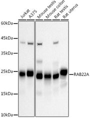 RAB22A Rabbit mAb