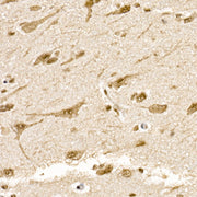 SOCS7 Rabbit mAb