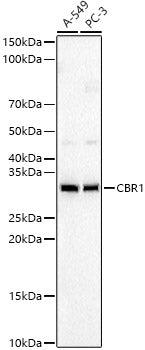 CBR1 Rabbit mAb