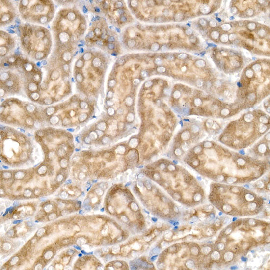 CBR1 Rabbit mAb