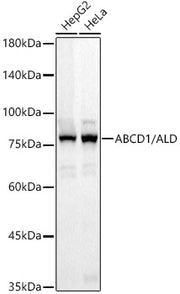 ABCD1 / ALD Rabbit mAb