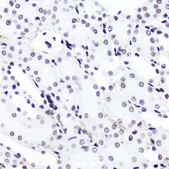 DiMethyl-Histone H3-K4 Rabbit pAb