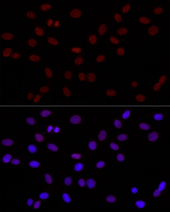 DiMethyl-Histone H3-K4 Rabbit pAb