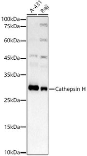 Cathepsin H Rabbit mAb