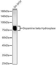 Dopamine beta Hydroxylase Rabbit mAb
