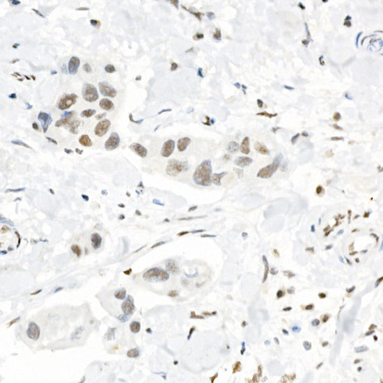 TriMethyl-Histone H3-K4 Rabbit pAb