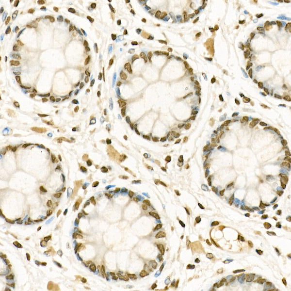 MonoMethyl-Histone H3-K9 Rabbit pAb