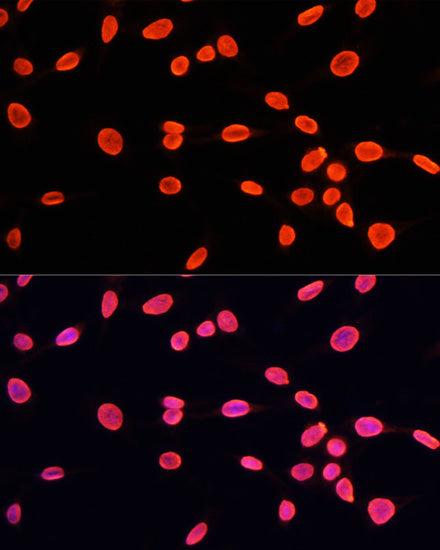 MonoMethyl-Histone H3-K9 Rabbit pAb