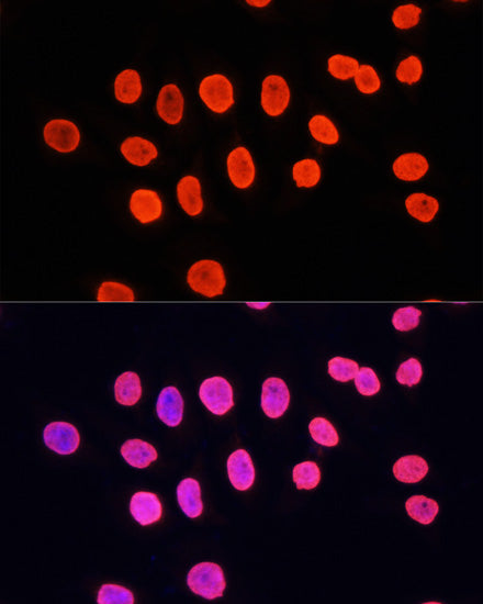 MonoMethyl-Histone H3-K9 Rabbit pAb