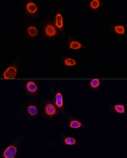 MonoMethyl-Histone H3-K9 Rabbit pAb