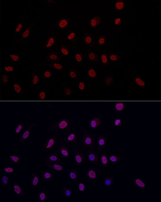 DiMethyl-Histone H3-K9 Rabbit pAb