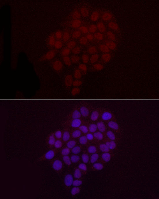 DiMethyl-Histone H3-K9 Rabbit pAb