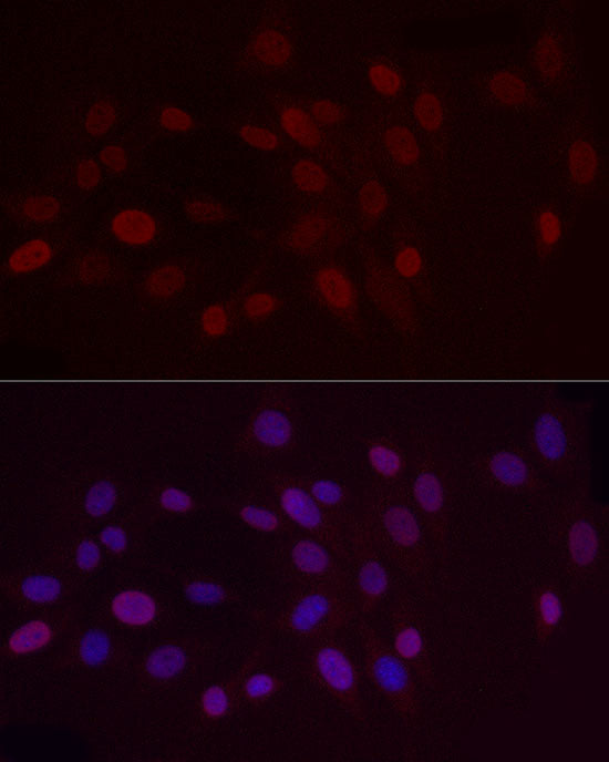 DiMethyl-Histone H3-K9 Rabbit pAb