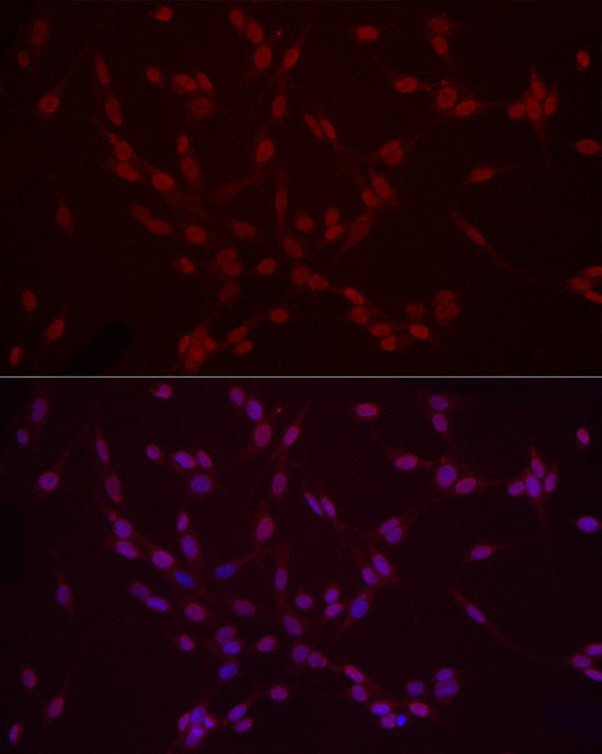 DiMethyl-Histone H3-K9 Rabbit pAb