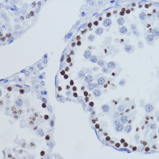 TriMethyl-Histone H3-K9 Rabbit pAb