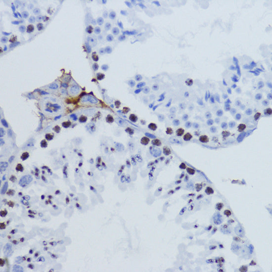 TriMethyl-Histone H3-K9 Rabbit pAb