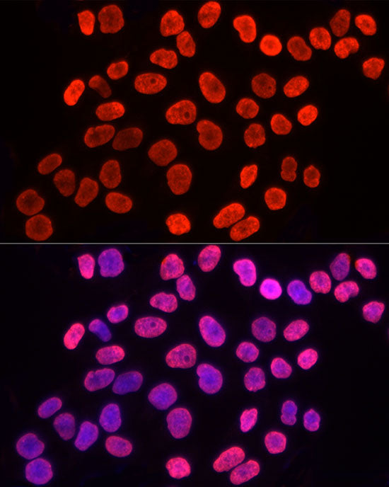 TriMethyl-Histone H3-K9 Rabbit pAb
