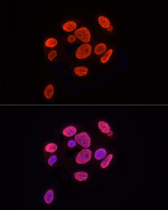 TriMethyl-Histone H3-K9 Rabbit pAb