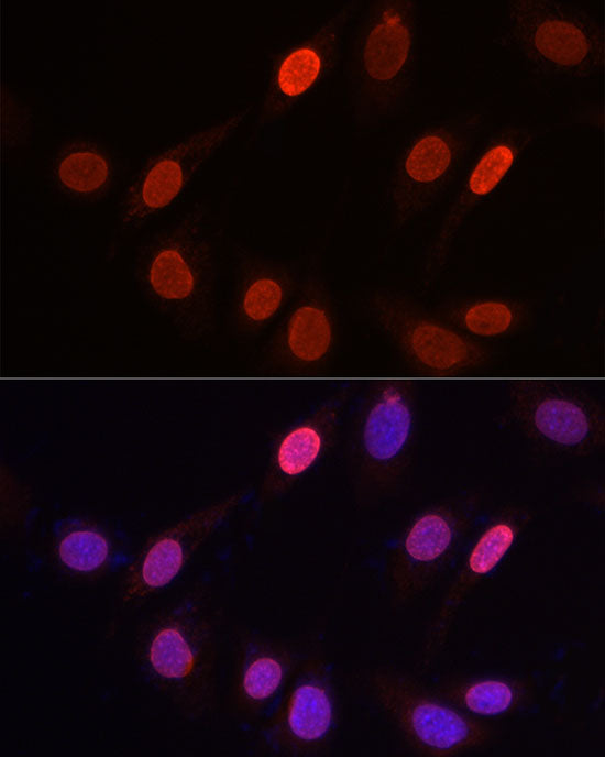 TriMethyl-Histone H3-K9 Rabbit pAb