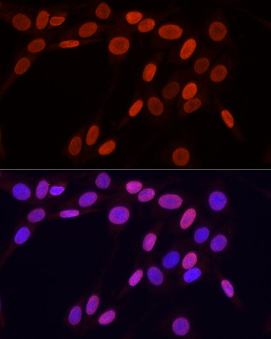TriMethyl-Histone H3-K9 Rabbit pAb
