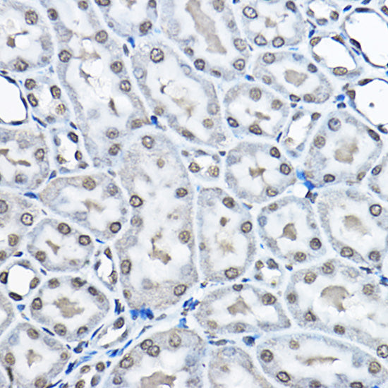 MonoMethyl-Histone H3-K27 Rabbit pAb