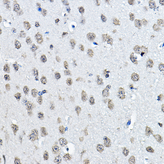 MonoMethyl-Histone H3-K27 Rabbit pAb