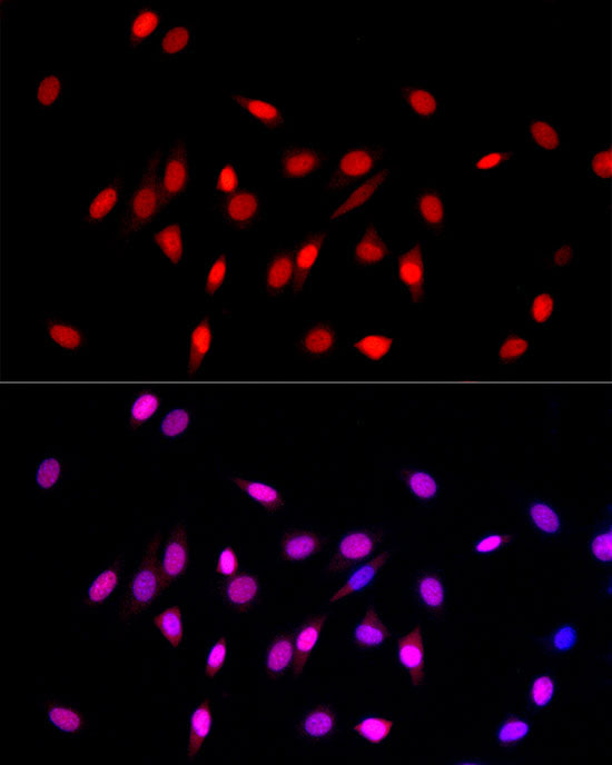 MonoMethyl-Histone H3-K27 Rabbit pAb