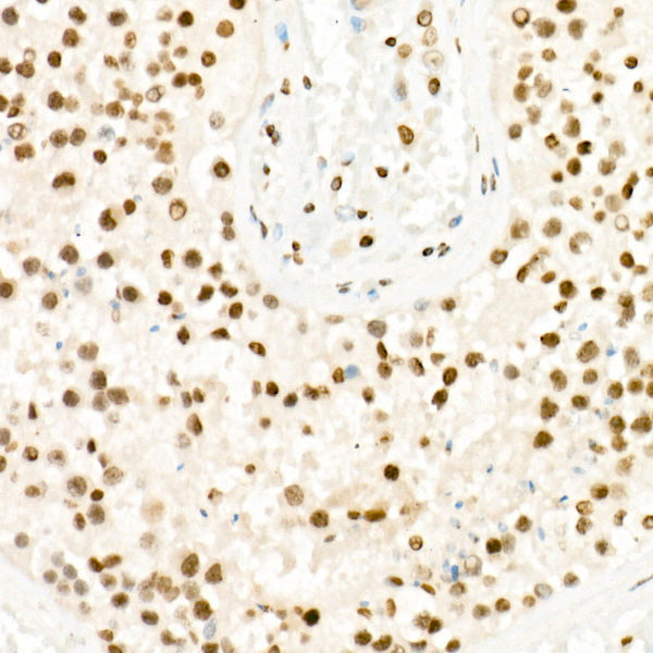 TriMethyl-Histone H3-K27 Rabbit pAb