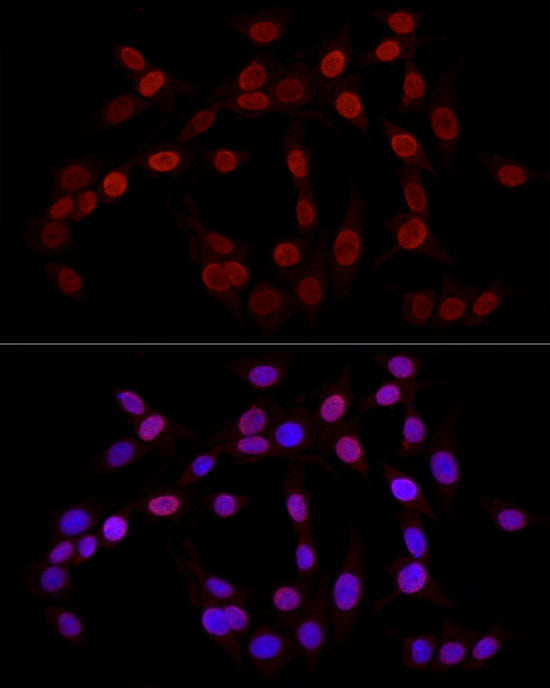 TriMethyl-Histone H3-K27 Rabbit pAb